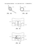 Robotic catheter systems and methods diagram and image