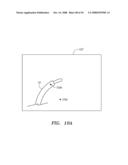 Robotic catheter systems and methods diagram and image