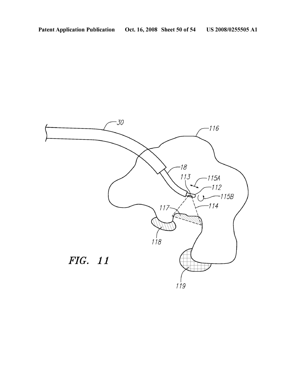 Robotic catheter systems and methods - diagram, schematic, and image 51