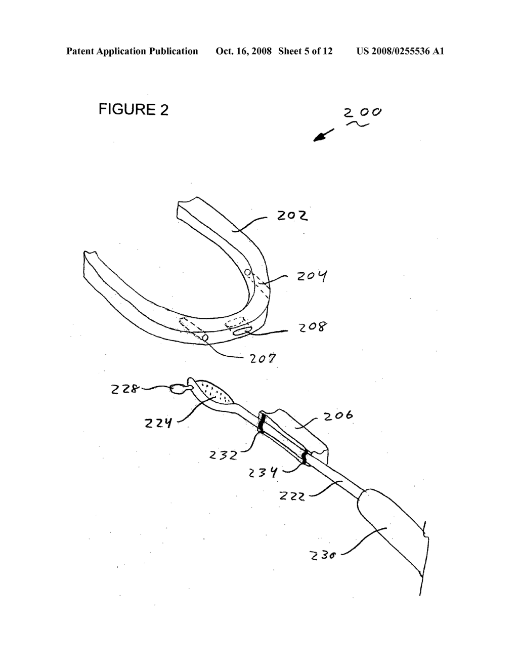 Methods and apparatuses for treating tonsils - diagram, schematic, and image 06