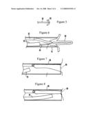 Systems and methods for less invasive neutralization by ablation of tissue including the appendix and gall bladder diagram and image