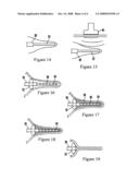 Systems and methods for less invasive neutralization by ablation of tissue including the appendix and gall bladder diagram and image