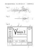 Fast Fibroadenoma Treatment System and method diagram and image