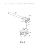 INSTRUMENTATION AND METHOD FOR PROVIDING SURGICAL ACCESS TO A SPINE diagram and image