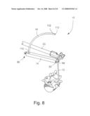 INSTRUMENTATION AND METHOD FOR PROVIDING SURGICAL ACCESS TO A SPINE diagram and image