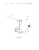 INSTRUMENTATION AND METHOD FOR PROVIDING SURGICAL ACCESS TO A SPINE diagram and image