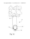 INSTRUMENTATION AND METHOD FOR PROVIDING SURGICAL ACCESS TO A SPINE diagram and image