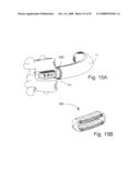 INSTRUMENTATION AND METHOD FOR PROVIDING SURGICAL ACCESS TO A SPINE diagram and image