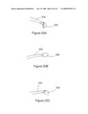 INSTRUMENTATION AND METHOD FOR PROVIDING SURGICAL ACCESS TO A SPINE diagram and image