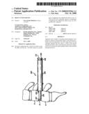 Bone cutting device diagram and image