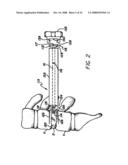 Bone cutting device diagram and image