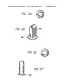 Bone cutting device diagram and image