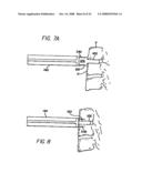 Bone cutting device diagram and image