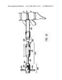 Bone cutting device diagram and image