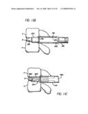 Bone cutting device diagram and image