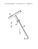 Bone cutting device diagram and image