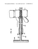 Bone cutting device diagram and image