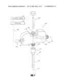 BONE TREATMENT SYSTEMS AND METHODS diagram and image