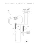 BONE TREATMENT SYSTEMS AND METHODS diagram and image