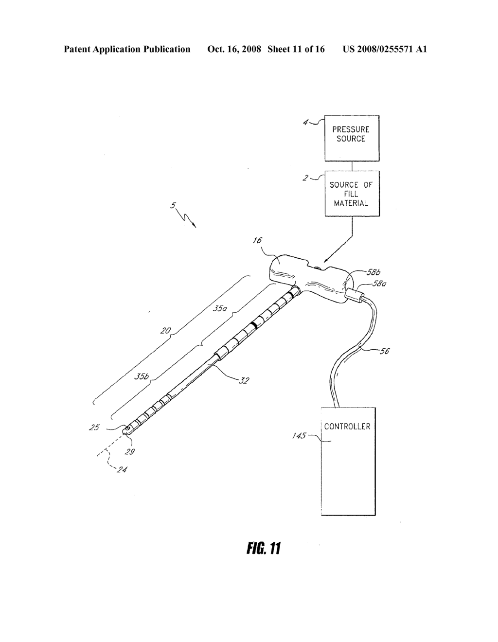 BONE TREATMENT SYSTEMS AND METHODS - diagram, schematic, and image 12