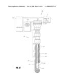 BONE TREATMENT SYSTEMS AND METHODS diagram and image