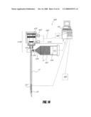 BONE TREATMENT SYSTEMS AND METHODS diagram and image