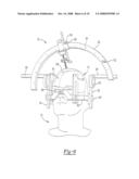 Method For Guiding Instruments Having Different Sizes diagram and image