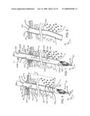 Resiliently deformable tool guide for use in minimally invasive telesurgical system diagram and image