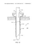 Resiliently deformable tool guide for use in minimally invasive telesurgical system diagram and image