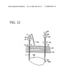 MEDICAL SUTURING TOOL WITH MULTIPLE PUNCTURE NEEDLES diagram and image