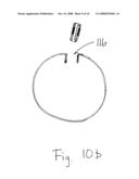 Apparatus and method for remote deflation of intragastric balloon diagram and image