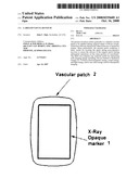 LABELED VASCULAR PATCH diagram and image