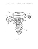 FACET FIXATION AND FUSION SCREW AND WASHER ASSEMBLY AND METHOD OF USE diagram and image