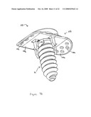 FACET FIXATION AND FUSION SCREW AND WASHER ASSEMBLY AND METHOD OF USE diagram and image