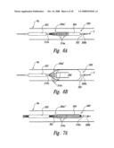 METHODS AND SYSTEMS FOR THERMALLY-INDUCED RENAL NEUROMODULATION diagram and image