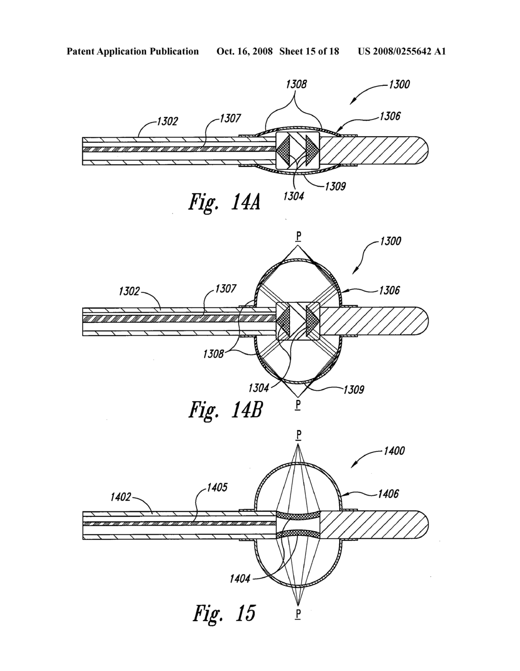 METHODS AND SYSTEMS FOR THERMALLY-INDUCED RENAL NEUROMODULATION - diagram, schematic, and image 16