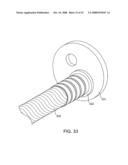 Implantable Addressable Segmented Electrodes diagram and image