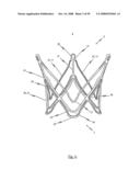 Medical device for treating a heart valve insufficiency or stenosis diagram and image