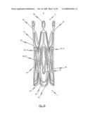 Medical device for treating a heart valve insufficiency or stenosis diagram and image