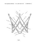 Medical device for treating a heart valve insufficiency or stenosis diagram and image