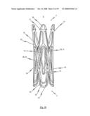 Medical device for treating a heart valve insufficiency or stenosis diagram and image