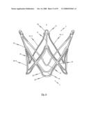 Medical device for treating a heart valve insufficiency or stenosis diagram and image