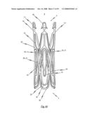 Medical device for treating a heart valve insufficiency or stenosis diagram and image