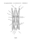 Medical device for treating a heart valve insufficiency or stenosis diagram and image