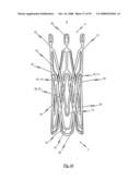 Medical device for treating a heart valve insufficiency or stenosis diagram and image