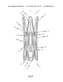 Medical device for treating a heart valve insufficiency or stenosis diagram and image