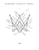 Medical device for treating a heart valve insufficiency or stenosis diagram and image