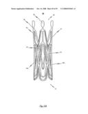 Medical device for treating a heart valve insufficiency or stenosis diagram and image