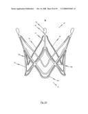 Medical device for treating a heart valve insufficiency or stenosis diagram and image