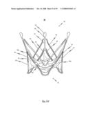 Medical device for treating a heart valve insufficiency or stenosis diagram and image